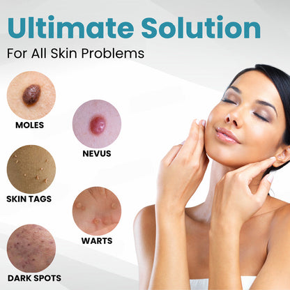 ✨Seurico™ Laser Pen - Non-invasive Mole and Wart Removal
