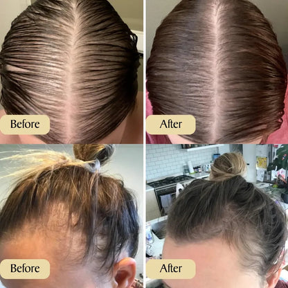 🌟 Last Day Sale – 80% OFF! 🌟Seurico™ Rosemary Hair Growth Oil 100% Natural Hair Growths
