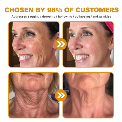 Negusy™ Botox-Infused Bee Venom Anti-Wrinkle Cream