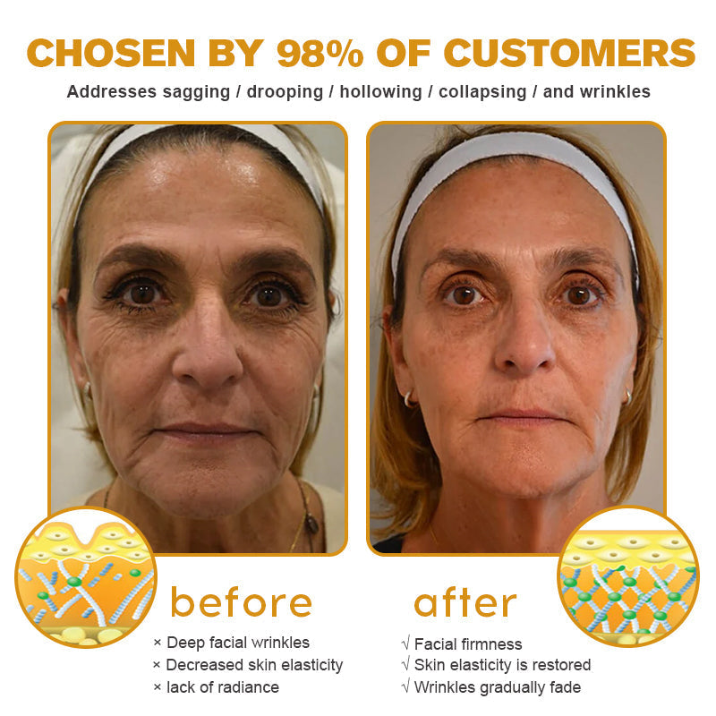 Negusy™ Botox-Infused Bee Venom Anti-Wrinkle Cream