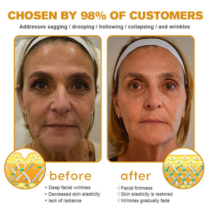 Negusy™ Botox-Infused Bee Venom Anti-Wrinkle Cream