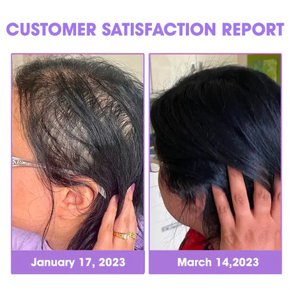 Odeiun™ ✨👩‍🔬 Odeiun™ Hair Root Repair Growth Drops – Fast Hair Growth, Repair Damaged Follicles, Restore Thick and Healthy Hair⚡