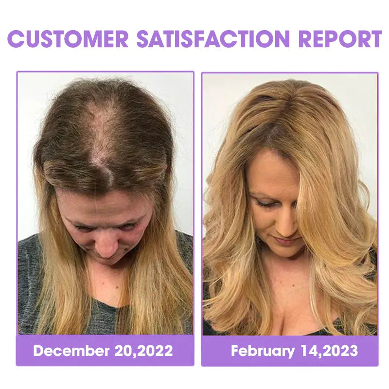 Odeiun™ ✨👩‍🔬 Odeiun™ Hair Root Repair Growth Drops – Fast Hair Growth, Repair Damaged Follicles, Restore Thick and Healthy Hair⚡