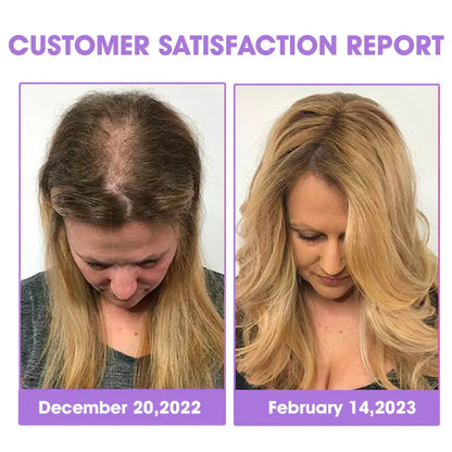 Odeiun™ ✨👩‍🔬 Odeiun™ Hair Root Repair Growth Drops – Fast Hair Growth, Repair Damaged Follicles, Restore Thick and Healthy Hair⚡